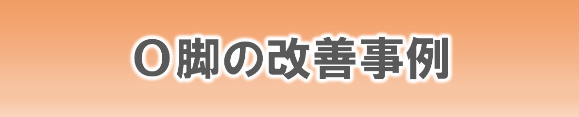 からだ工房整体院のО脚の改善事例